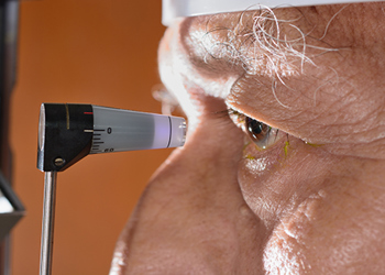 Glaucoma: Why Early Detection is Critical photo
