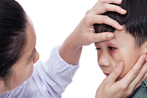Signs of Possible Eye Trouble in Children