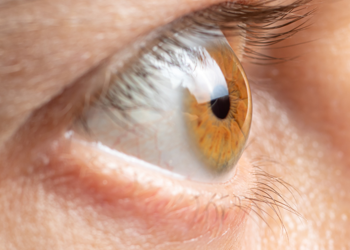 Glaucoma FAQs photo